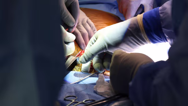 Pig Kidney Transplant 4 1713095627800 1713095669809
