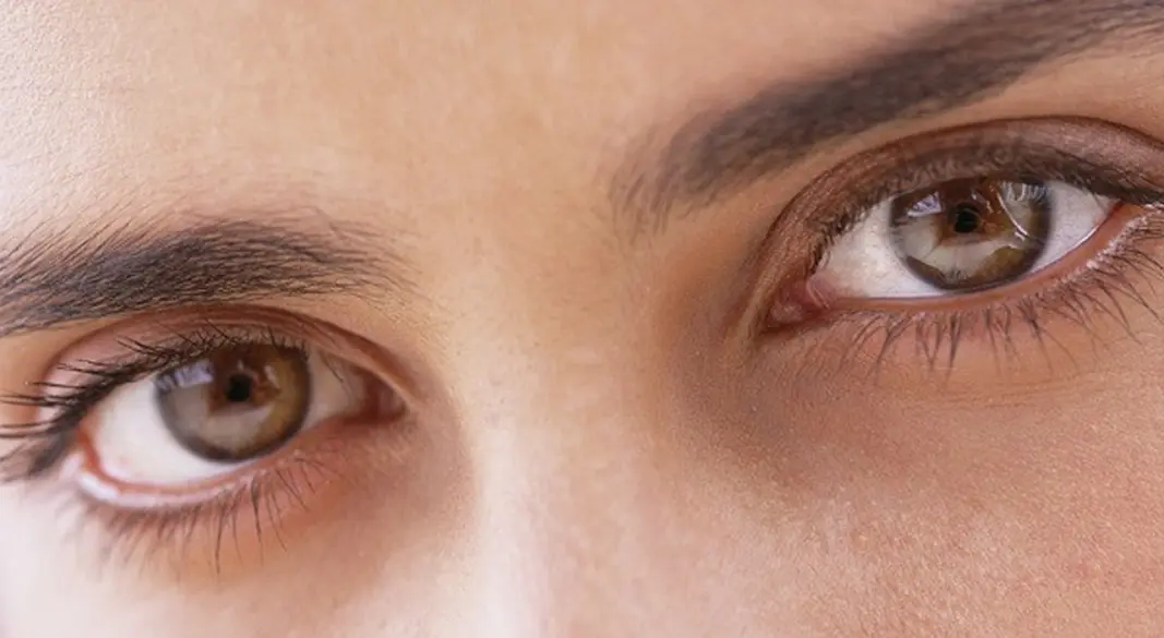 ছানি অপারেশন