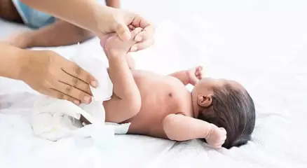 শিশুর মলদ্বারে পলিপ